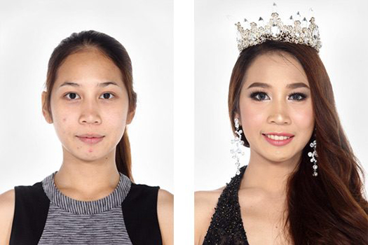 Hình ảnh trước sau