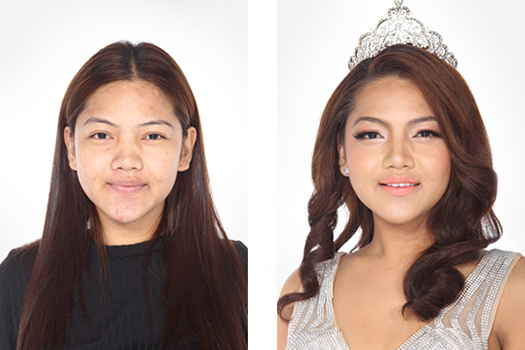 Hình ảnh trước sau