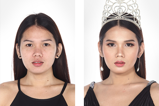 Hình ảnh trước sau